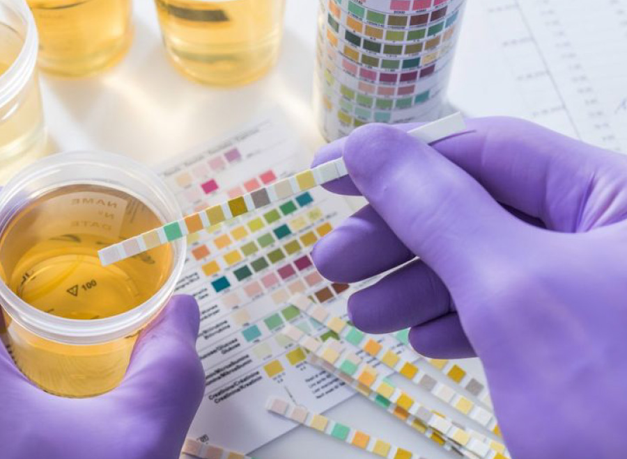 Instant urine analysis to improve diagnostic efficiency